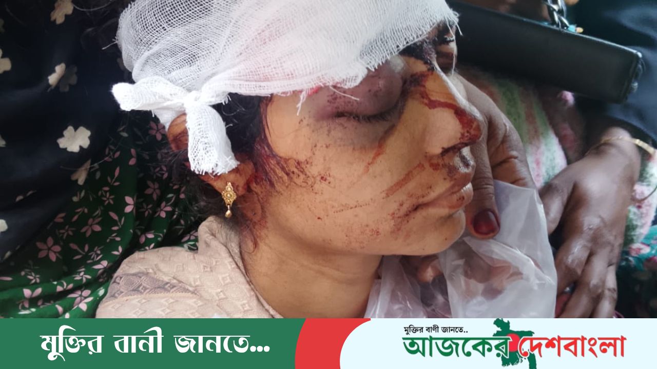 বদলগাছীতে ঘরে ঢুকে গৃহবধূকে কুপিয়ে জখম, জনমনে আতঙ্ক