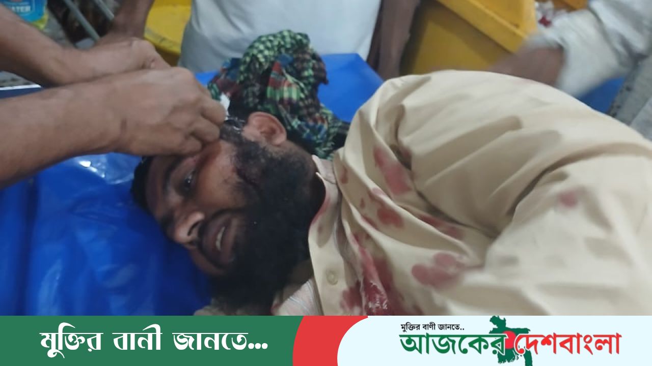 চৌদ্দগ্রামে আওয়ামী লীগ নেতার হামলায়  জামায়াত কর্মী আহত