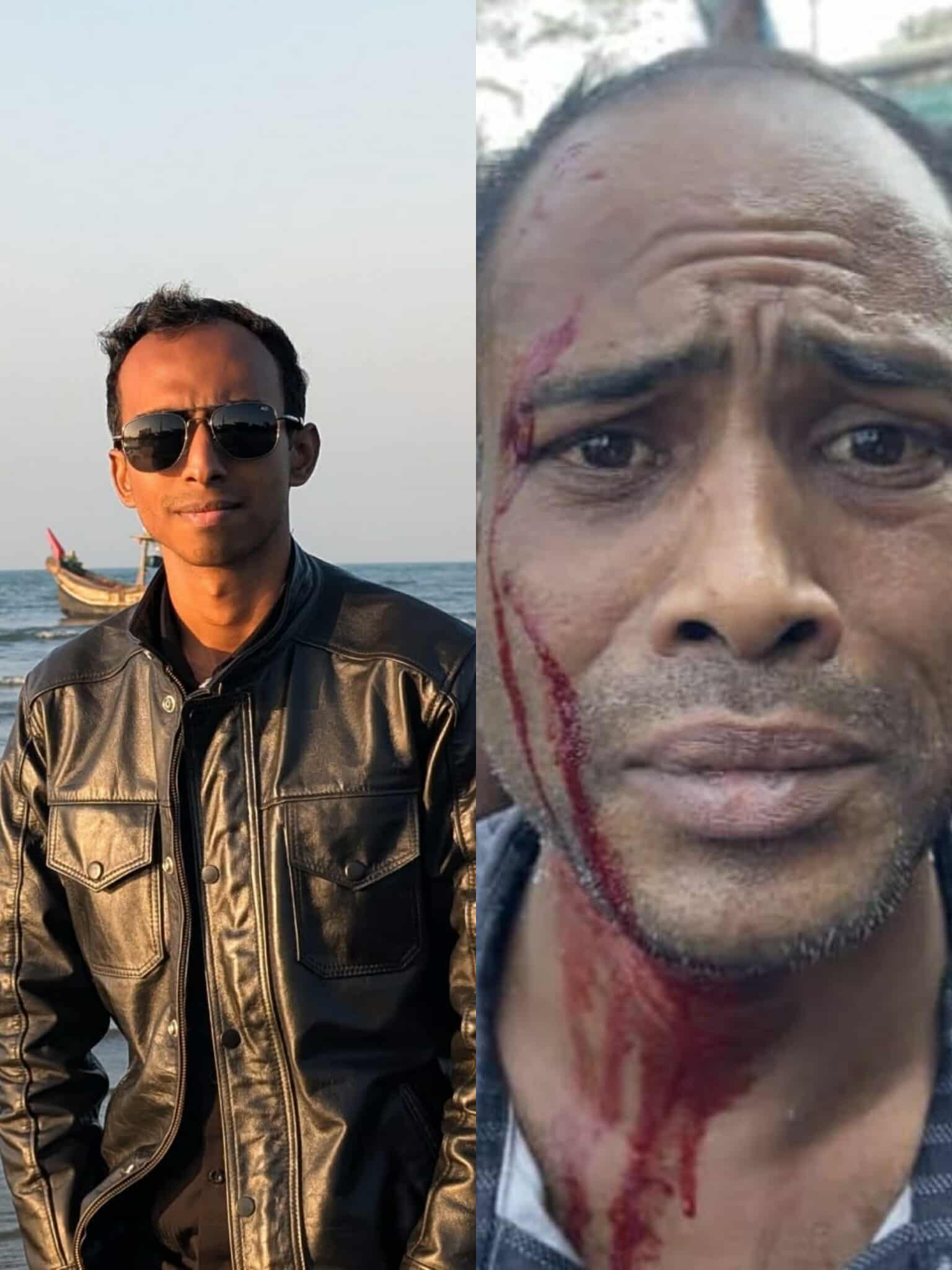 জাবিতে শিক্ষকের আঘাতে আহত বাসচালক; ছাত্রদল নেতার নেতৃত্বে পুনরায় মারধরের অভিযোগ